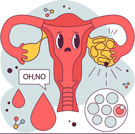Female reproductive system  일러스트레이션