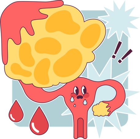 Female reproductive system  Illustration