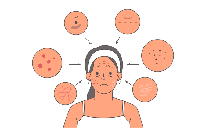 Une femme souffrant d'acné et de rides sur le visage ou de fissures sur la peau sèche a besoin de l'aide d'un cosmétologue  Illustration