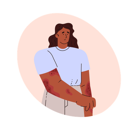 Femme avec un problème de peau  Illustration