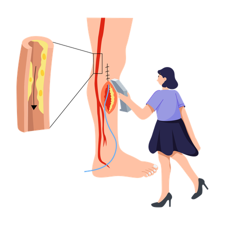 Femme faisant une chirurgie de la jambe  Illustration