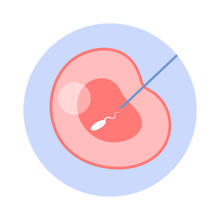 Fertilización artificial del óvulo de mujer.  Ilustración