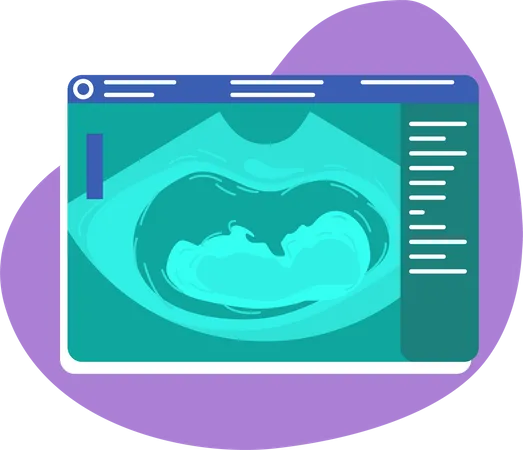 Fetal ultrasound Illustration