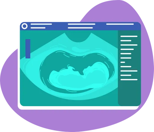 Fetal ultrasound  Illustration