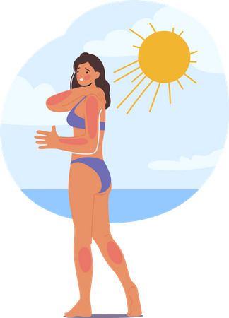 Frau erleidet am Strand aufgrund übermäßiger Sonneneinstrahlung einen Sonnenbrand  Illustration