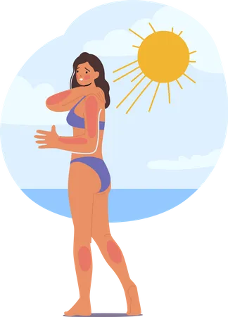 Frau erleidet am Strand aufgrund übermäßiger Sonneneinstrahlung einen Sonnenbrand  Illustration