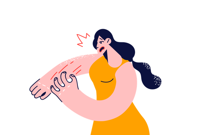Frau leidet an Krätze, verursacht durch Läuse, während sie sich die Hand kratzt, bis sie blutet  Illustration