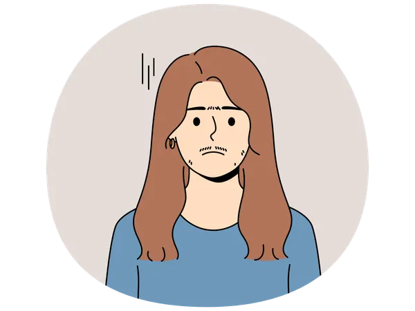 Frau leidet unter Hirsutismus, der zu Schnurrbartwachstum und dicken Augenbrauen im Gesicht führt  Illustration