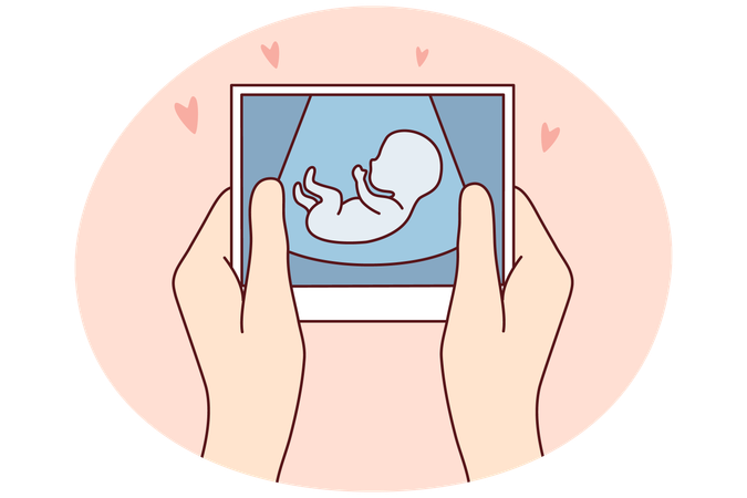 Future mother hold scan of embryo  Illustration