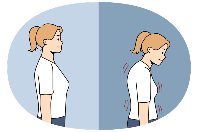 Gebeugte Frau vor und nach der Haltungskorrektur dank Massagetherapeut oder Chiropraktiker  Illustration