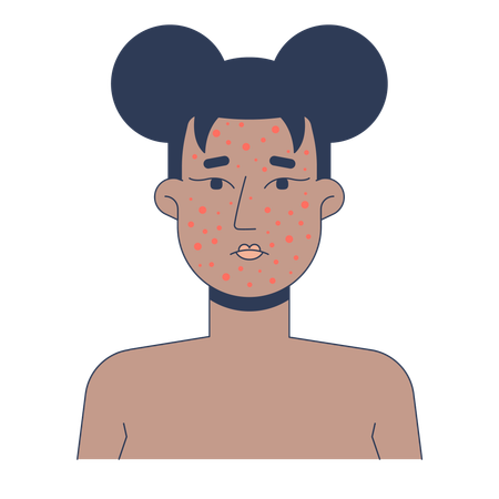 Gesicht einer schwarzen Frau mit schwerer Akne  Illustration