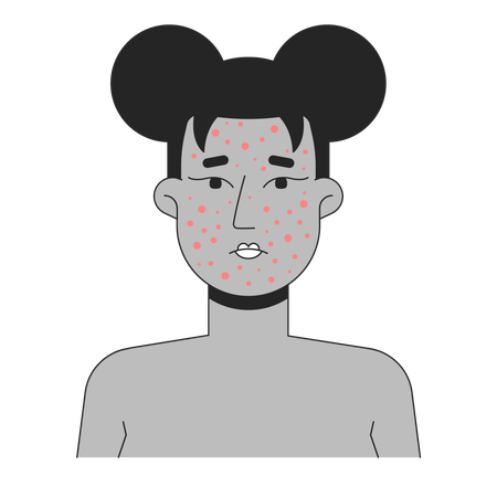 Gesicht einer schwarzen Frau mit schwerer Akne  Illustration