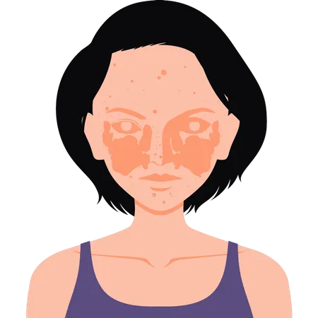 Girl  has an allergy on her face  Illustration