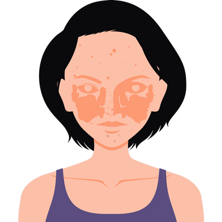 Girl  has an allergy on her face  Illustration