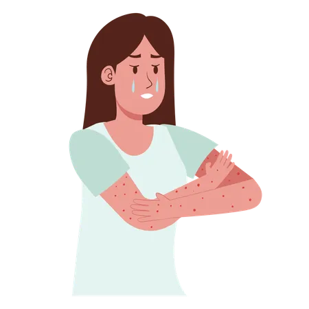 Girl having Itching at hand due to Allergy  Illustration