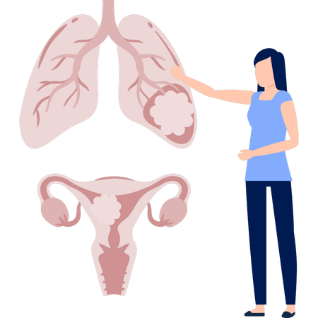 Girl  showing follicle in human lungs  Illustration