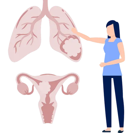 Girl  showing follicle in human lungs  Illustration