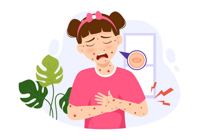 Girl suffering Monkeypox  イラスト