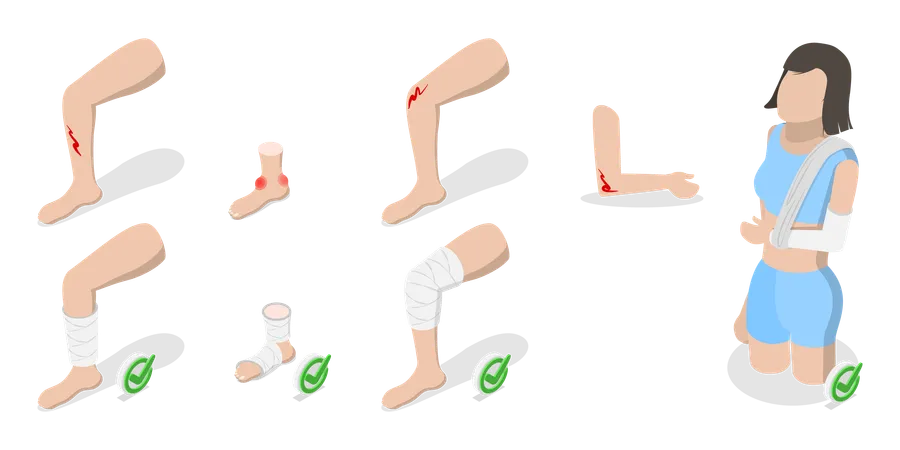 3 D Isometric Flat Vector Illustration Of How To Heal Injuries Methods Of Bandaging Illustration