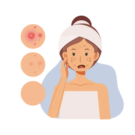 Problem Skin Concept Woman With Pimples On Her Face Facial Skin Troubled Flat Vector Cartoon Character Illustration Illustration
