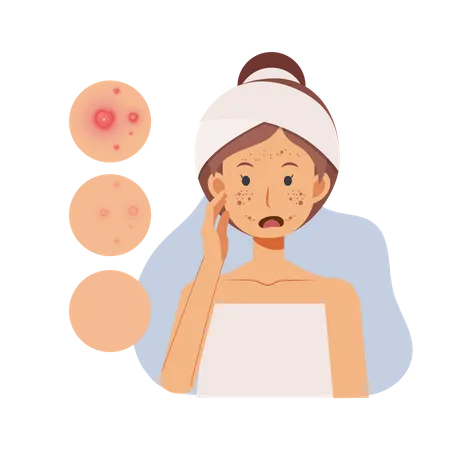 Girl with Acne On Face  Illustration