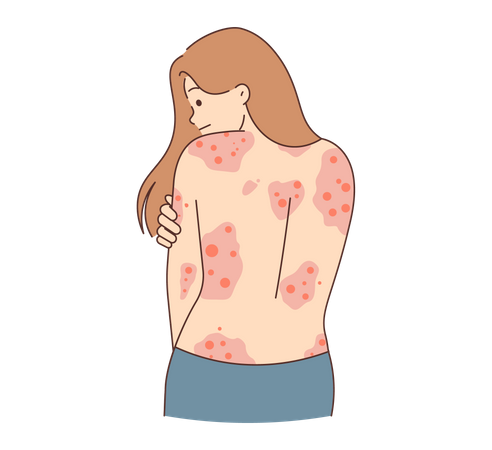 Girl with skin rashes  Illustration