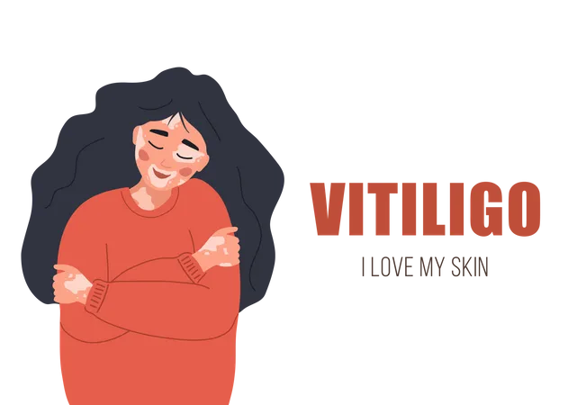 Woman With Vitiligo Self Care And Self Love World Vitiligo Day Skin Disease Vector Illustration In Flat Cartoon Style Illustration