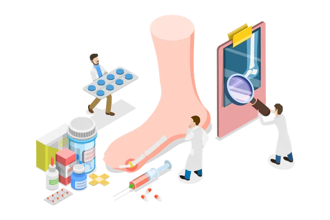 3 D Isometric Flat Vector Conceptual Illustration Of Gout Treatment Medical Appointment And Exam Illustration