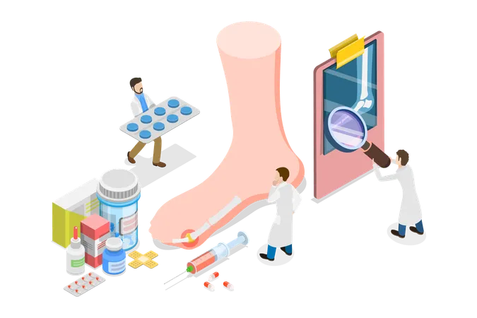 Gout Treatment  Illustration