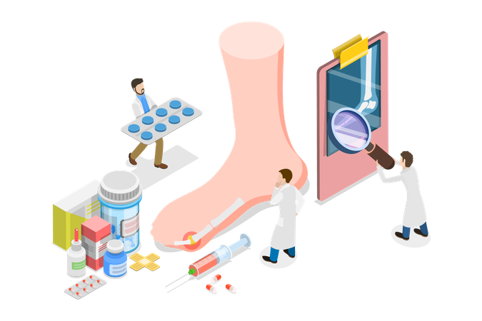Gout Treatment  일러스트레이션