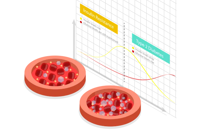 Ilustracion Conceptual De Vector Plano Isometrico 3 D De Resistencia A La Insulina Grafico Comparativo Ilustración