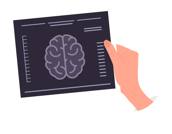 Hand holding MRI result of Brain  Illustration