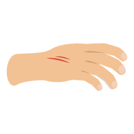Hand with physical injury  Illustration