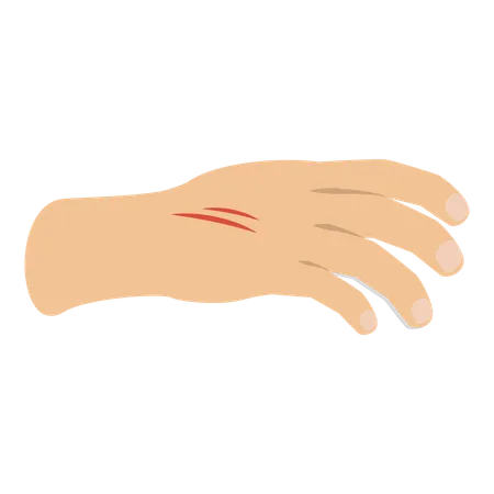 Hand with physical injury  Illustration