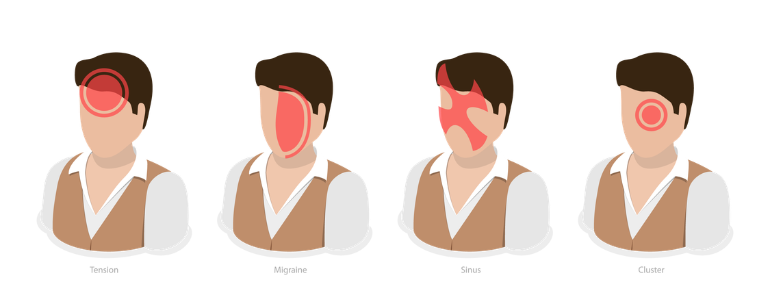 Headache Types  Illustration