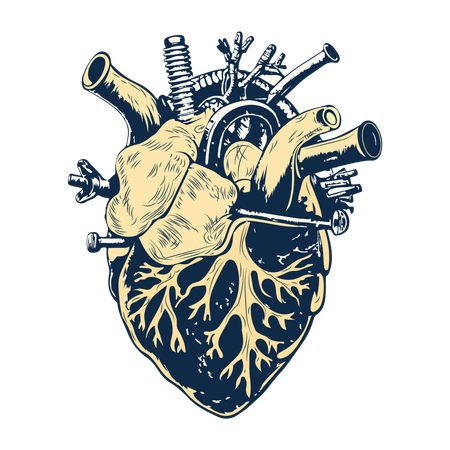 Heart Surgery  Illustration