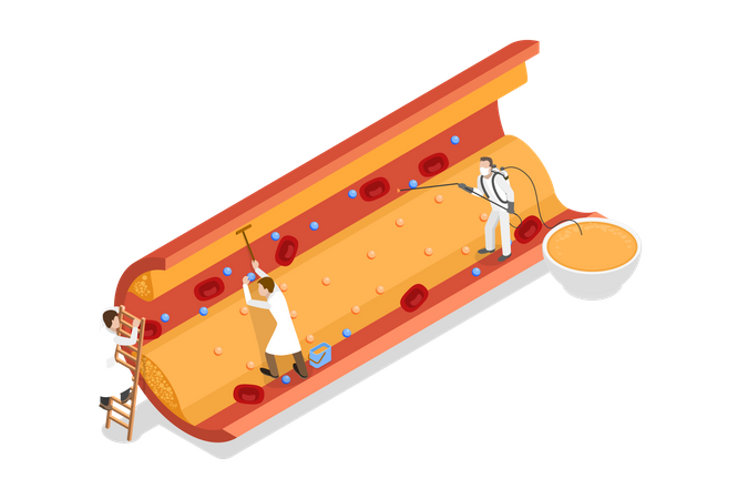 High Cholesterol  Illustration