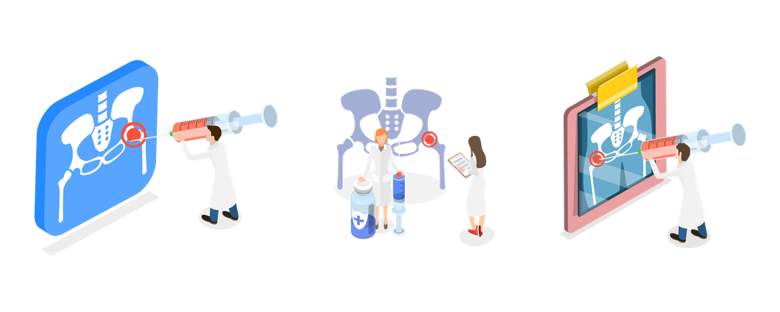 Hip Joint Cortisone Injection, Bones of the Pelvis and Hip  Illustration