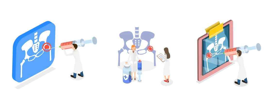 Hip Joint Cortisone Injection, Bones of the Pelvis and Hip  Illustration