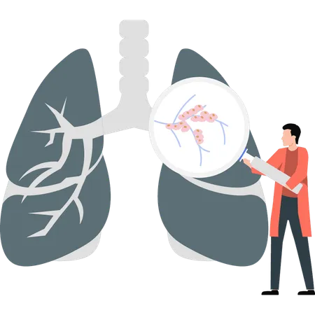 Hombre buscando información sobre enfermedades pulmonares.  Ilustración