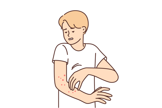Hombre con sarpullido en el brazo sufre picazón  Ilustración