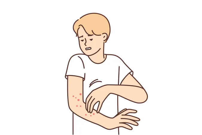 Hombre con sarpullido en el brazo sufre picazón  Ilustración
