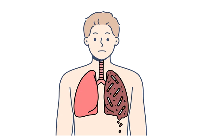 Hombre fumador con pulmones destrozados  Ilustración