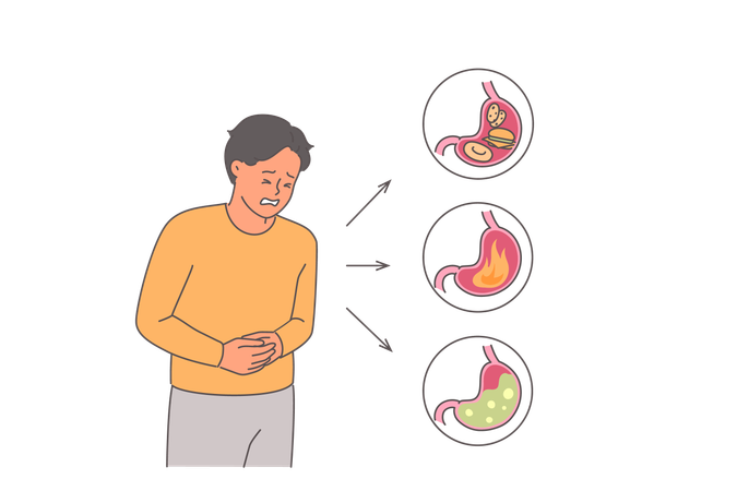 El hombre sufre de dolor abdominal debido a problemas estomacales y necesita ayuda de un gastroenterólogo  Ilustración