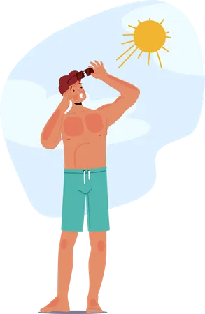 Homem sofre queimaduras solares dolorosas na praia  Ilustração