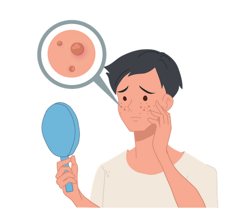 Homem que sofre de acne olha no espelho  Ilustração