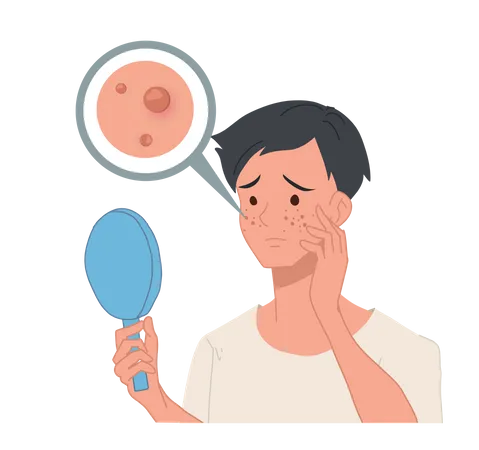 Homem que sofre de acne olha no espelho  Ilustração