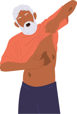 Homem sênior que sofre de problema de alergia na pele  Ilustração