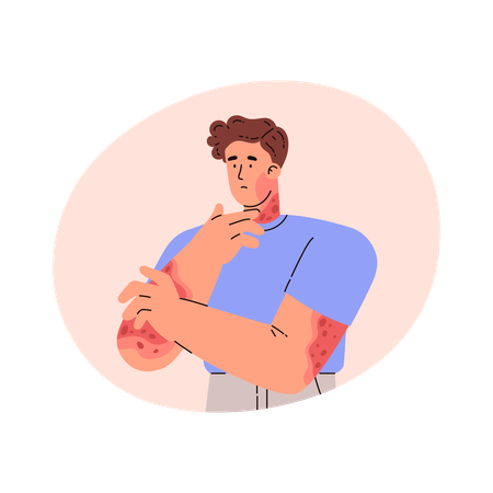 Homme avec un problème de peau sur les mains  Illustration