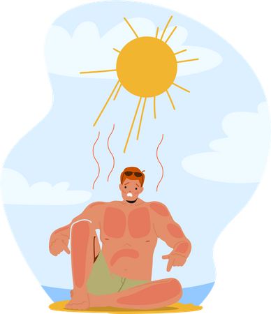 Homme grimaçant de douleur suite à un coup de soleil sur la plage  Illustration